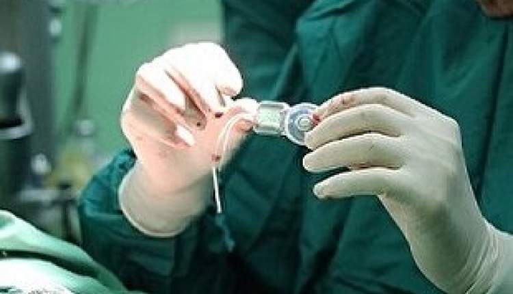 کاشت رایگان حلزون شنوایی در مراکز دولتی و برخی مراکز خصوصی